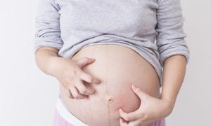 孕妇nt值高2.6正常吗