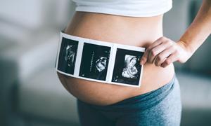 孕妇促甲状腺激素大于3怎么回事