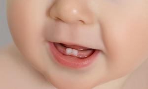 八个月小孩拉肚子怎么办