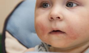 母乳性黄疸断奶几天后回奶怎么办