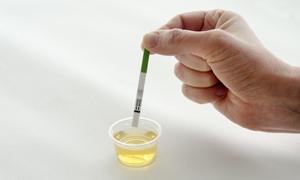 排卵日怎样算 排卵日怎样算